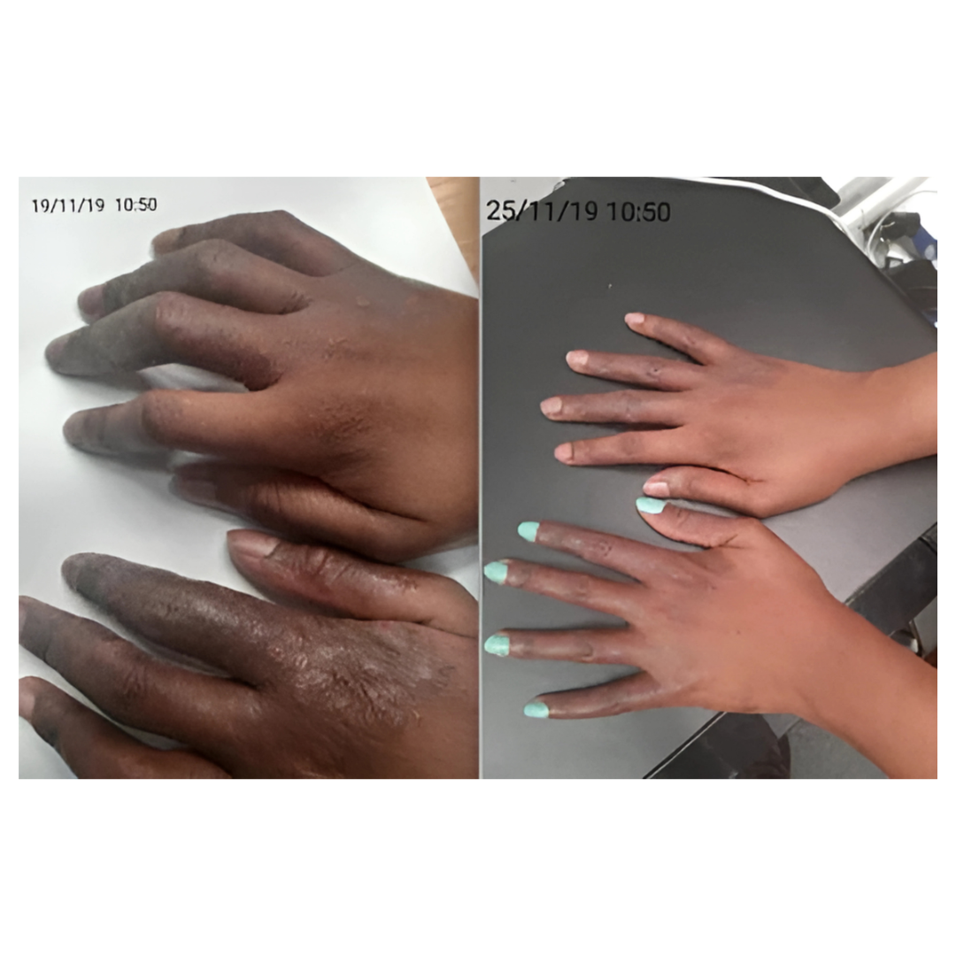 CBD Sensitive Skin Balm